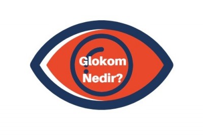 Glokom (Göz Tansiyonu) Nasıl Tedavi Edilir? Glokom Belirtileri Nedenleri