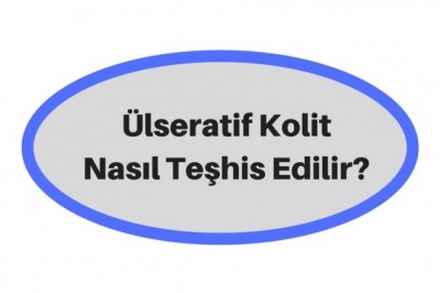 Ülseratif Kolit  Hastalığı Nedir? Belirtileri ve Tedavi Yöntemleri 