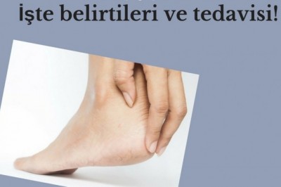 Topuk dikeni (Plantar Fasiit) neden olur belirtileri nelerdir?