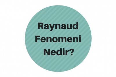 Raynaud Fenomeni (Sendromu) Belirtileri Evreleri ve Tedavisi