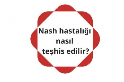 Nash hastalığı (Non-Alkolik Steatohepatit) nedir? Nash hastalığı belirtileri ve tedavisi