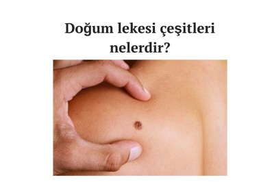 Doğum lekeleri neden olur zararlı mıdır? Doğum lekesi çeşitleri ve tedavi yöntemleri